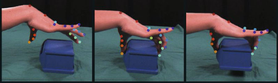 Fingergelenke einer Hand beim Greifen eines Objektes/ Finger joints of a hand when gripping an object