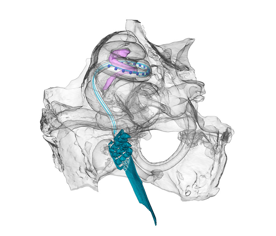 Modell eines optischen Cochlea Implantats in der Hörschnecke einer Wüstenrennmaus/