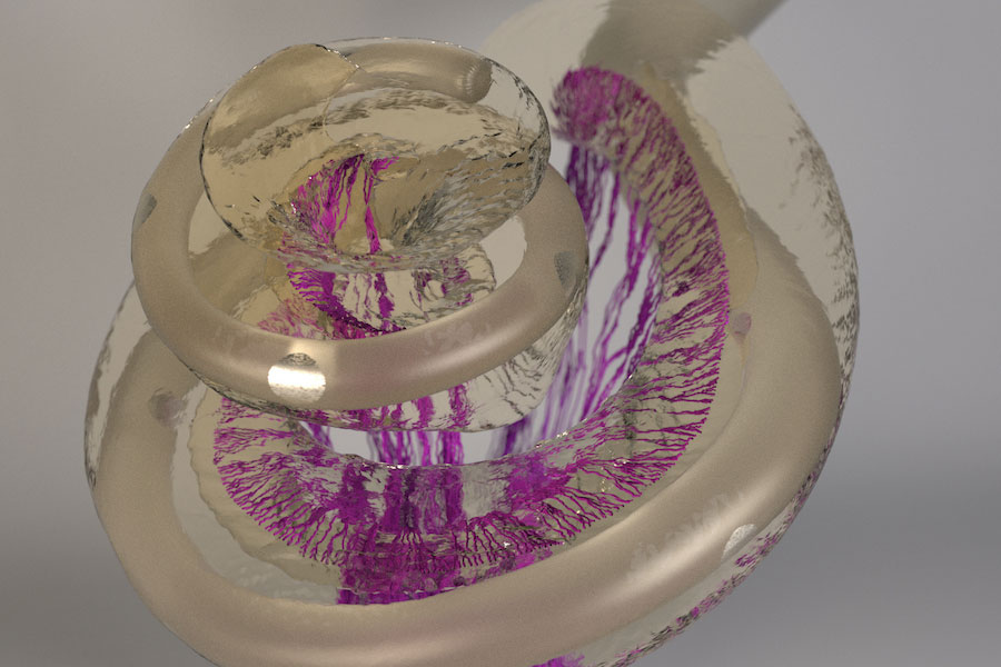 3D image of the human inner ear with an inserted cochlear implant electrode 