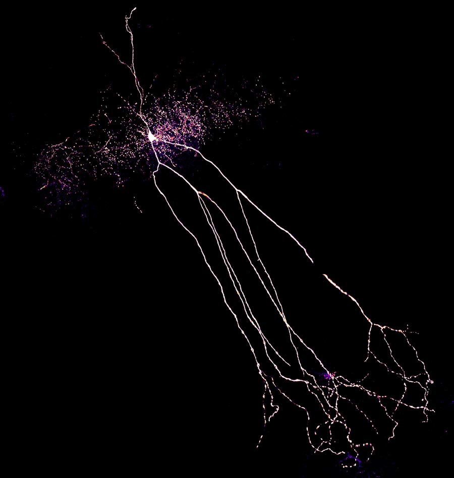 Ein Interneuron/ An interneuron
