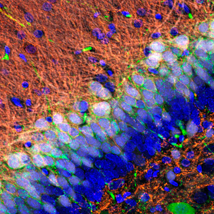 Körnerzellen/ Granule cells