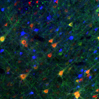 Angefärbte Nervenzellen im prämotorischen Kortex eines Rhesusaffen/ Stained nerve cells in the pre-motor cortex of a rhesus monkey