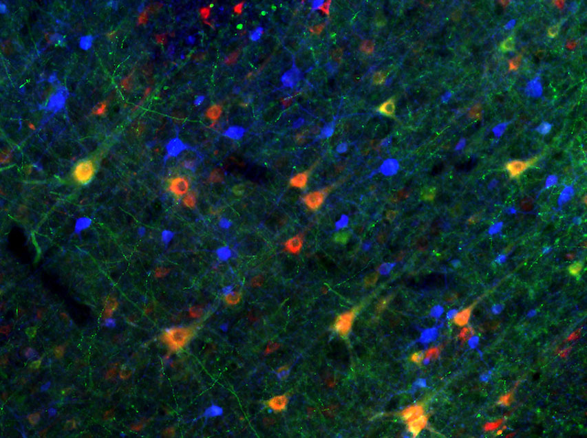 Angefärbte Nervenzellen im prämotorischen Kortex eines Rhesusaffen/ 