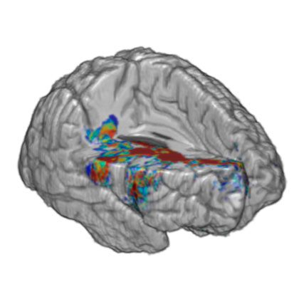 Darstellung Gehirn/Grafic Brain