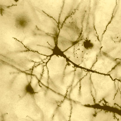Nervenzellen/ Nerve cells