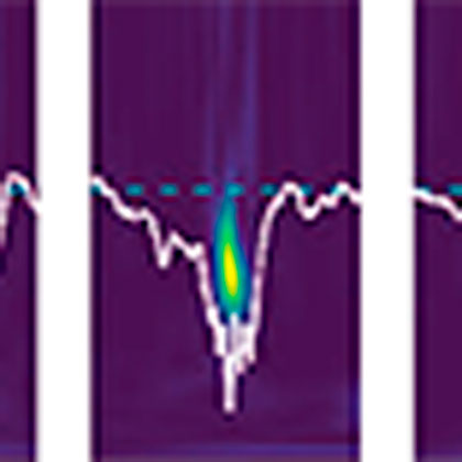 Spektrogramm der neuronalen Feldpotentiale im Hippocampus/ Spectrogram of neuronal field potentials in the hippocampus