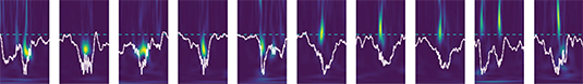 Spektrogramm der neuronalen Feldpotentiale im Hippocampus/ Spectrogram of neuronal field potentials in the hippocampus