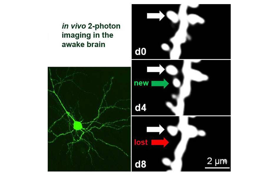 Fluoreszenzmarkierte Nervenzellen in der Hirnrinde wacher Mäuse/ Fluorescently labelled visual cortical neurons in the living adult mouse brain