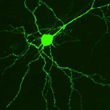 Fluoreszenzmarkierte Nervenzellen in der Hirnrinde wacher Mäuse